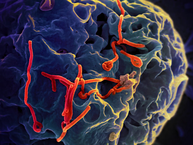 Ebola virus, NIAID