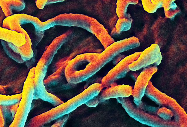 Ebola virus ONE, NIAID