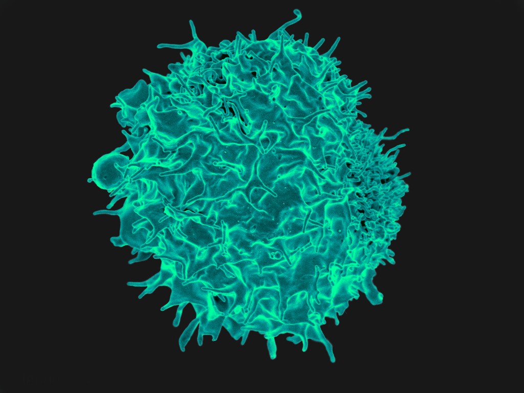 Lymphocyte