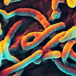 Zmapp: Targeting Weak Spots on the Ebola Virus