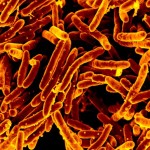 Tuberculosis Vaccines: Need and Challenges