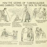 Tuberculosis: A Very Old Disease