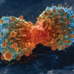 Super Natural Killer Cells: Modified Lymphocytes Prevent the Spread of Cancer